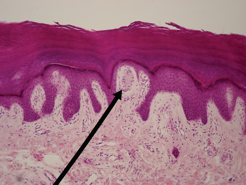 Light micrograph of a Meissner corpuscle, an elongated capsule of stacked cell layers sitting inside a dermal papilla just beneath the skin surface